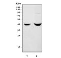 Western blot testing of 1) rat liver and 2) mouse liver tissue lysate with Vegfc antibody. Predicted molecular weight ~46 kDa.