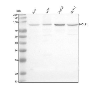 Western blot analysis of NOL11 using anti-NOL11 antibody. Lane 1: human Hela whole cell lysates, Lane 2: human whole cell lysates, Lane 3: human HepG2 whole cell lysates, Lane 4: human MCF-7 whole cell lysates. After electrophoresis, proteins were transferred to a nitrocellulose membrane at 150 mA for 50-90 min. Blocked the membrane with 5% non-fat milk/TBS for 1.5 hour at RT.