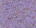 IHC staining of FFPE rat spleen tissue with Cd39 antibody. HIER: boil tissue sections in pH8 EDTA for 20 min and allow to cool before testing.