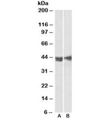 Western blot testing of Jurkat [A] and MOLT4 [B] lysates with CD123 antibody at 2ug/ml. Predicted molecular weight ~43kDa.