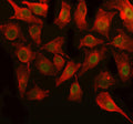 Immunofluorescent staining of OGFOD3 using anti-OGFOD3 antibody (green) and anti-Beta Tubulin antibody (red). OGFOD3 was detected in immunocytochemical section of cell. Enzyme antigen retrieval was performed using IHC enzyme antigen retrieval reagent for 15 mins. The cells were blocked with 10% goat serum. And then incubated with 5 ug/ml rabbit anti-OGFOD3 antibody and mouse anti-Beta Tubulin antibody overnight at 4oC.