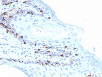 IHC staining of FFPE human skin with recombinant Melan-A antibody (clone rMLANA/4576). HIER: boil tissue sections in pH 9 10mM Tris with 1mM EDTA for 20 min and allow to cool before testing.