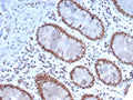 IHC staining of FFPE human colon tissue with Nucleolin antibody (clone NCL/7337). HIER: boil tissue sections in pH 9 10mM Tris with 1mM EDTA for 20 min and allow to cool before testing.