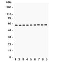 Western blot testing of HSP60 antibody and Lane 1: rat kidney; 2: mouse kidney; 3: (m) HEPA; 4: (r) NRK; 5: (r) PC12; 6: human SW620; 7: (h) A549; 8: (h) A431; 9: (h) HeLa lysate. Predicted/observed molecular weight: ~60 kDa.