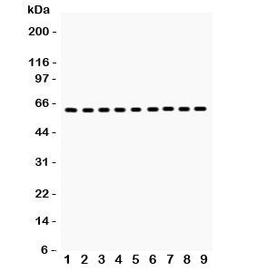 Western blot testing of HSP60 antibody and Lane 1: rat kidney; 2: mouse kidney; 3: (m) HEPA; 4: (r) NRK; 5: (r) PC12; 6: human SW620; 7: (h) A549; 8: (h) A431; 9: (h) HeLa lysate. Predicted/observed molecular weight: ~60 kDa.