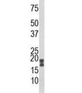 Western blot analysis of ACP1 antibody and human HeLa lysate. Predicted molecular weight 14-18 kDa (isoforms 1-3).