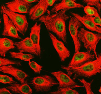 Immunofluorescent staining of PHF8 using anti-PHF8 antibody (green) and anti-Beta Tubulin antibody (red). PHF8 was detected in an immunocytochemical section of HELA cells. Enzyme antigen retrieval was performed using IHC enzyme antigen retrieval reagent for 15 mins. The cells were blocked with 10% goat serum. And then incubated with 5 ug/ml rabbit anti-PHF8 antibody and mouse anti-Beta Tubulin antibody overnight at 4oC.