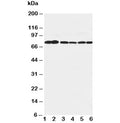 Western blot testing of B Raf antibody and Lane 1: rat brain; 2: rat testis; 3: rat liver; 4: (h) SW620; 5: (h) COLO320; 6: (r) PC-12 cell lysate. Predicted molecular weight: 85-95 kDa.