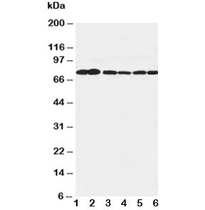 Western blot testing of B Raf antibody and Lane 1: rat brain; 2: rat testis; 3: rat liver; 4: (h) SW620; 5: (h) COLO320; 6: (r) PC-12 cell lysate. Predicted molecular weight: 85-95 kDa.