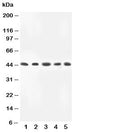 Western blot testing of MKK4 antibody and Lane 1: rat skeletal muscle; 2: HeLa; 3: A549; 4: MM231; 5: CEM lysate. Predicted molecular weight ~44 kDa.