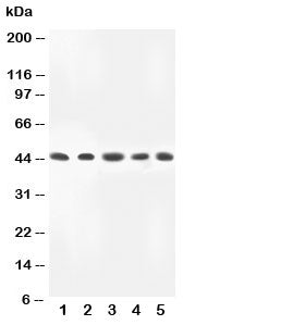 Western blot testing of MKK4 antibody and Lane 1: rat skeletal muscle; 2: HeLa; 3: A549; 4: MM231; 5: CEM lysate. Predicted molecular weight ~44 kDa.