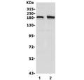 Western blot testing of human 1) SW620 and 2) U-87 MG lysate with hSET1 antibody. Predicted molecular weight ~186 kDa.