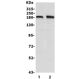 Western blot testing of human 1) SW620 and 2) U-87 MG lysate with hSET1 antibody. Predicted molecular weight ~186 kDa.