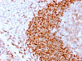 IHC staining of FFPE human tonsil tissue with recombinant CD79b antibody (clone IGB/3170R). HIER: boil tissue sections in pH 9 10mM Tris with 1mM EDTA for 10-20 min followed by cooling at RT for 20 min.