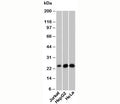 Western blot testing of human samples with NKIRAS1 antibody at 6ug/ml.