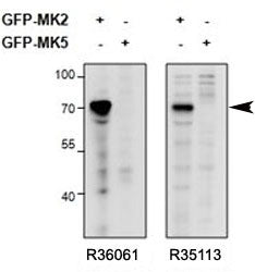 Western blot of HEK293 lysate overexpressing mouse MK2/MAPKAPK2-GFP or overexpressing MK5-GFP and probed with MAPKAPK2 antibody (0.5ug/ml, <a href=../tds/mapkapk2-antibody-r36061>catalog # R36061</a>) in the left panel and with MAPKAPK2 antibody (0.5ug/ml, cat # R35113) in the right panel.