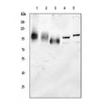 Western blot testing of 1) human HepG2, 2) human Jurkat, 3) human HeLa, 4) mouse brain and 5) mouse lung tissue lysate with LAMP1 antibody. This heavily glycosylated protein of 417 amino acids can be visualized at up to 140 kDa.
