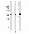Western blot analysis of lysate from 1) MCF-7, 2) HeLa cell line and 3) human skeletal muscle tissue lysate using ALDOA antibody at 1:1000. Predicted molecular weight ~40 kDa.