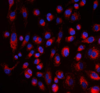 Immunofluorescent staining of FFPE human PC-3 cells with ALDH1A2 antibody (red) and DAPI nuclear stain (blue). HIER: steam section in pH6 citrate buffer for 20 min.