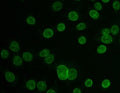 Immunofluorescent staining of FFPE human Caco-2 cells with TPR antibody. HIER: steam section in pH6 citrate buffer for 20 min.