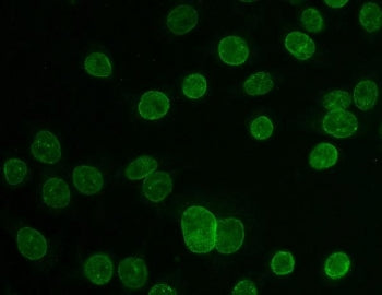 Immunofluorescent staining of FFPE human Caco-2 cells with TPR antibody. HIER: steam section in pH6 citrate buffer for 20 min.