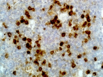 IHC testing of FFPE human tonsil tissue with recombinant Human Lambda Light Chain antibody. A pH6 Citrate buffer or pH9 Tris/EDTA buffer HIER step is recommended for testing of FFPE tissue sections.