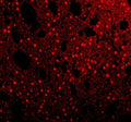 Immunofluorescent staining of FFPE rat brain tissue with SAM68 antibody (red). HIER: steam section in pH8 EDTA buffer for 20 min.