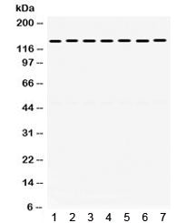 Western blot testing of 1) rat brain, 2) rat liver, 3) rat testis, 4) human HeLa, 5) human A549, 6) human MCF7 and 7) mouse NIH3T3 lysate with SMC3 antibody. Exepcted/observed molecular weight ~141 kDa.