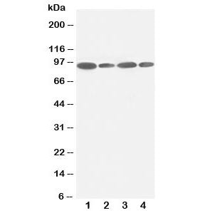 Western blot testing of FES antibody and Lane 1: HeLa; 2: 293T; 3: SKOV; 4: A549 lysate. Predicted molecular weight ~93 kDa.
