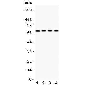 Western blot testing of Neuregulin-1 antibody and Lane 1: MCF-7; 2: SKOV; 3: 22RV1; 4: COLO320 lysate. Predicted/observed size ~70KD