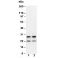 Western blot testing of MBP antibody and mouse brain tissue lysate. Multiple isoforms may be visualized from 20~37 kDa.