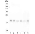 Western blot testing of human 1) HeLa, 2) T-47D, 3) HepG2, 4) K562, 5) mouse liver and 6) mouse HEPA1-6 lysate with RMI2 antibody at 0.5ug/ml. Expected molecular weight ~18 kDa.