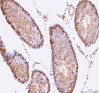 Immunohistochemical staining of STK16 using anti-STK16 antibody. STK16 was detected in a paraffin-embedded section of mouse testis tissue. Heat mediated antigen retrieval was performed in EDTA buffer (pH 8.0, epitope retrieval solution). The tissue section was blocked with 10% goat serum. The tissue section was then incubated with 2 ug/ml rabbit anti-STK16 antibody overnight at 4oC. Peroxidase Conjugated Goat Anti-rabbit IgG was used as secondary antibody and incubated for 30 min at 37oC.