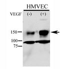 Phospho-KDR antibody used in western blot to detect phosphorylated KDR/FLK1 in HMVEC lysate. Endothelial cells were stimulated with 50ug/ml VEGF for 5min and Ab used at 1:500. Predicted molecular weight: ~152 (immature), 180-200 kDa (intermediate) and 220-230 kDa (mature).