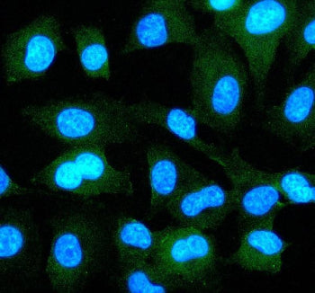 Immunofluorescent staining of EPS8 using anti-EPS8 antibody (green). EPS8 was detected in an immunocytochemical section of cells. Enzyme antigen retrieval was performed using IHC enzyme antigen retrieval reagent for 15 mins. The cells were blocked with 10% goat serum. And then incubated with 5 ug/ml rabbit anti-EPS8 antibody overnight at 4oC. DyLight 488 Conjugated Goat Anti-Rabbit IgG was used as secondary antibody at 1:500 dilution and incubated for 30 min at 37oC.