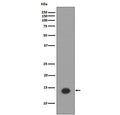 Western blot testing of lysate from human HeLa cells treated with Trichostatin A, with acetyl-Histone H2A Antibody (Lys9). Predicted molecular weight ~14 kDa.