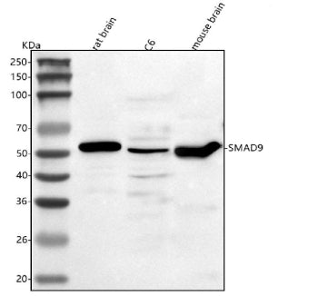 Western blot analysis of Smad9 using anti-Smad9 antibody. Lane 1: rat brain tissue lysates, Lane 2: rat C6 whole cell lysates, Lane 3: mouse brain tissue lysates. After electrophoresis, proteins were transferred to a nitrocellulose membrane at 150 mA for 50-90 min. Blocked the membrane with 5% non-fat milk/TBS for 1.5 hour at RT.