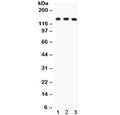 Western blot testing of 1) rat liver, 2) mouse liver and 3) human SMMC lysate with ABCB11 antibody. Expected/observed molecular weight ~146 kDa.