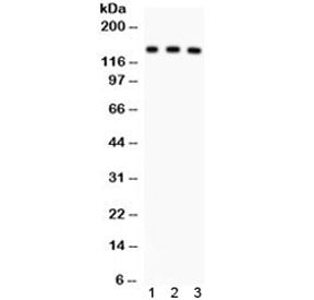Western blot testing of 1) rat liver, 2) mouse liver and 3) human SMMC lysate with ABCB11 antibody. Expected/observed molecular weight ~146 kDa.