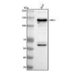 Western blot analysis of LRIG1 using anti-LRIG1 antibody. Lane 1: human 293T whole cell lysates. After electrophoresis, proteins were transferred to a nitrocellulose membrane at 150 mA for 50-90 min. Blocked the membrane with 5% non-fat milk/TBS for 1.5 hour at RT.