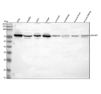 Western blot analysis of GALNT7 using anti-GALNT7 antibody. Lane 1: human Hela whole cell lysates, Lane 2: human HepG2 whole cell lysates, Lane 3: human whole cell lysates, Lane 4: human Hacat whole cell lysates, Lane 5: rat brain tissue lysates, Lane 6: rat kidney tissue lysates, Lane 7: mouse brain tissue lysates, Lane 8: mouse kidney tissue lysates. After electrophoresis, proteins were transferred to a nitrocellulose membrane at 150 mA for 50-90 min.