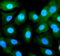 Immunofluorescent staining of RBCK1 using anti-RBCK1 antibody (green). RBCK1 was detected in an immunocytochemical section of cells. Enzyme antigen retrieval was performed using IHC enzyme antigen retrieval reagent for 15 mins. The cells were blocked with 10% goat serum. And then incubated with 5 ug/ml rabbit anti-RBCK1 antibody overnight at 4oC. DyLight 488 Conjugated Goat Anti-Rabbit IgG was used as secondary antibody at 1:500 dilution and incubated for 30 min at 37oC.