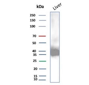 Western blot testing of human liver tissue lysate using AKR1C1 antibody (clone AKR1C1/9070). Predicted molecular weight ~37 kDa.