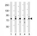 Western blot testing of DRP1 antibody at 1:1000 dilution and lysates: Lane 1: human heart; 2: LNCaP; 3: mouse NIH3T3; 4: rat PC12; 5: HeLa; Predicted molecular weight: 60-84 kDa (multiple isoforms).