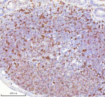 Immunohistochemical staining of Lat using anti-Lat antibody. Lat was detected in a paraffin-embedded section of mouse intestinal lymph nodes tissue. Heat mediated antigen retrieval was performed in EDTA buffer (pH 8.0, epitope retrieval solution). The tissue section was blocked with 10% goat serum. The tissue section was then incubated with 2 ug/ml rabbit anti-Lat antibody overnight at 4oC. Peroxidase Conjugated Goat Anti-rabbit IgG was used as secondary antibody and incubated for 30 min at 37oC.