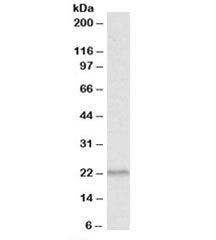 Western blot testing of human thymus lysate with PSMB9 antibody at 1ug/ml. Predicted molecular weight: ~23kDa.