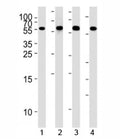 Western blot analysis of lysate from 1) HepG2, 2) NCI-H460,3) Raji, and 4) Ramos cell line using MMP3 antibody at 1:1000. Predicted molecular weight ~54kDa.