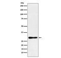 Western blot testing of human MCF7 cell lysate with DDAH2 antibody. Predicted molecular weight ~29 kDa.