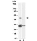 Western blot testing of human testis lysate with TCFL5 antibody at 0.3ug/ml with [B] and without [A] blocking/immunizing peptide. Predicted molecular weight: ~53kDa.