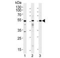 Western blot testing of 1) human A549, 2) human HepG2 and 3) rat testis lysate with ALK2 antibody at 1:1000. Predicted molecular weight ~57 kDa.